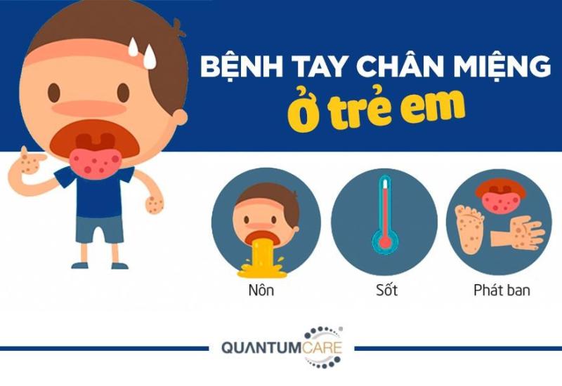 Tập huấn bệnh Tay chân miệng 